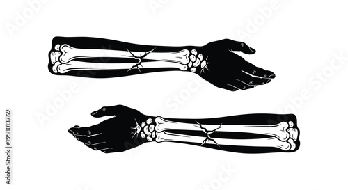 Broken arms with skeletal detail depicted as a dark silhouette