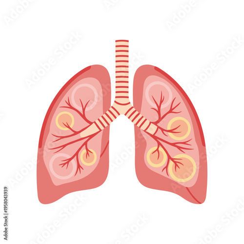 Human lungs with bronchial tree.
