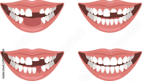 Progressive Illustration of Dental Restoration and Orthodontic Alignment, From Missing Teeth to a Perfect Smile