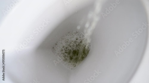 Close-up of foamy urine in a toilet bowl illustrating symptoms of proteinuria or kidney disease in a clinical health concept.