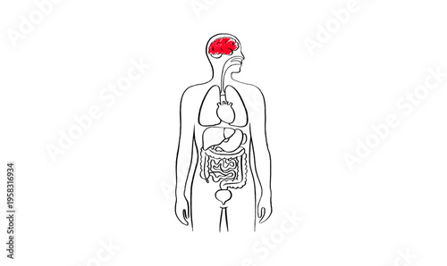 Brain disease concept
