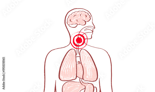 Throat inflammation pain