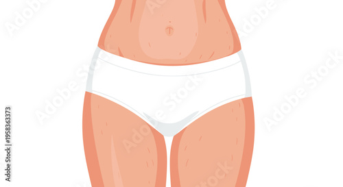 A close-up illustration shows a female torso from the waist down wearing white briefs against a white background.