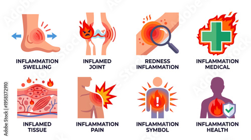 Vector illustrations of inflammation symptoms include swelling, inflamed joints, redness, and medical symbols on human body parts.