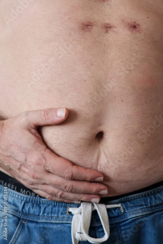 close-up of a fat man's belly