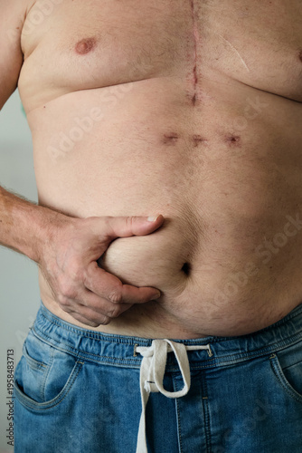 close-up of a fat man's belly