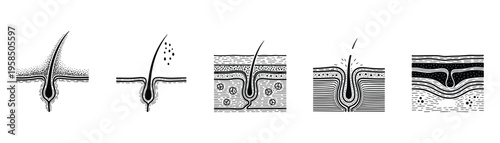 Hair follicle steps vector illustration. Hair loss, growth and skin structure