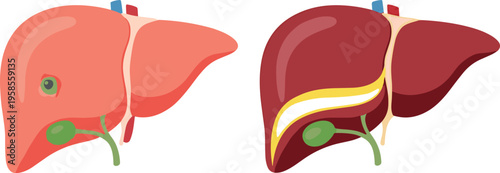 Liver anatomy illustration comparing healthy liver and diseased liver with bile duct and gallbladder details in clean medical flat vector style