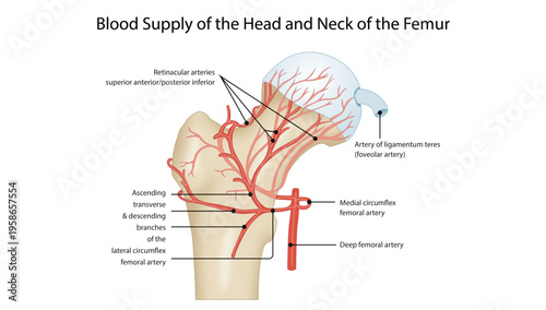 Blood Supply of the Head and Neck of the Femur
Anatomical diagram showing arterial supply to the femoral head including retinacular arteries, medial and lateral circumflex femoral arteries, and artery