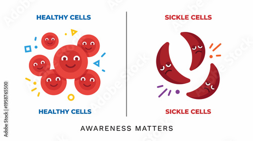 Sickle Cells Versus Healthy Red Blood Cells An Illustration of Sickle Cell Anemia Awareness