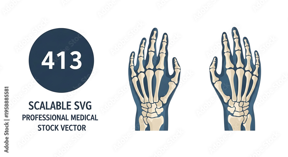 Obraz premium A scalable vector graphic of a human hand skeleton in a medical illustration style