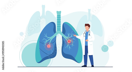 Doctor examining lungs with nodules, medical illustration of respiratory disease diagnosis