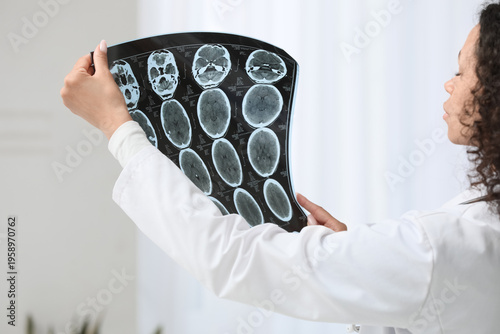 Tableau sur toile Beautiful young African-American female neurologist with MRI scan of human head