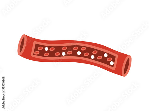 Diabetes Disease or Glucose in Blood Vessels