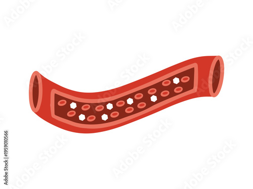 Diabetes Disease or Glucose in Blood Vessels