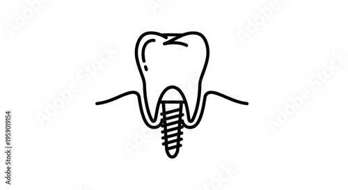 Dental Implant Icon: Tooth Root Replacement with Screw in Gum Line