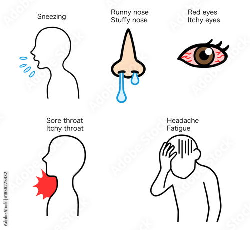 花粉症や風邪の主な症状まとめ：くしゃみ・鼻水・目のかゆみ・喉の痛みなどのインフォグラフィック