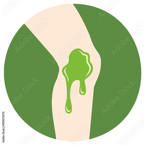 Knee Joint Injury with Green Liquid, Illustration, Medical Concept, Health Problem, Vector, Minimalist Style, Body Part