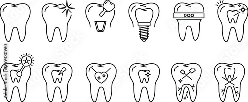 Dental tooth decay and damage illustrations