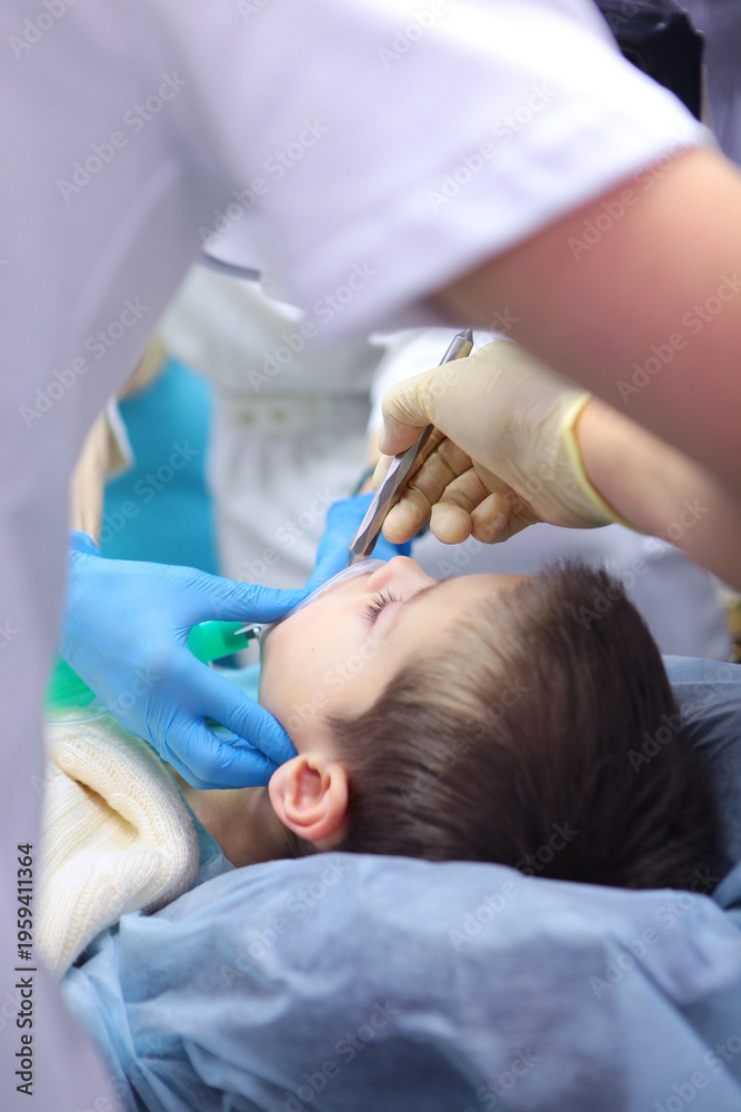Fototapeta premium Treatment of baby teeth under general anesthesia. The child is under anesthesia. Treatment of several baby teeth at once. The concept of healthcare.