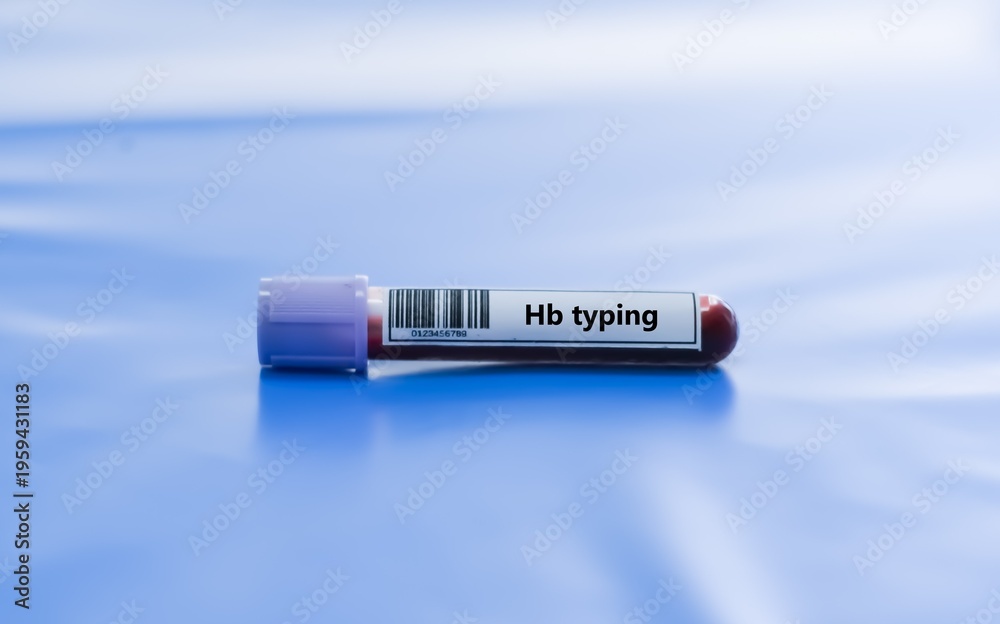 Fototapeta premium Blood sample tube for hemoglobin typing test analysis.