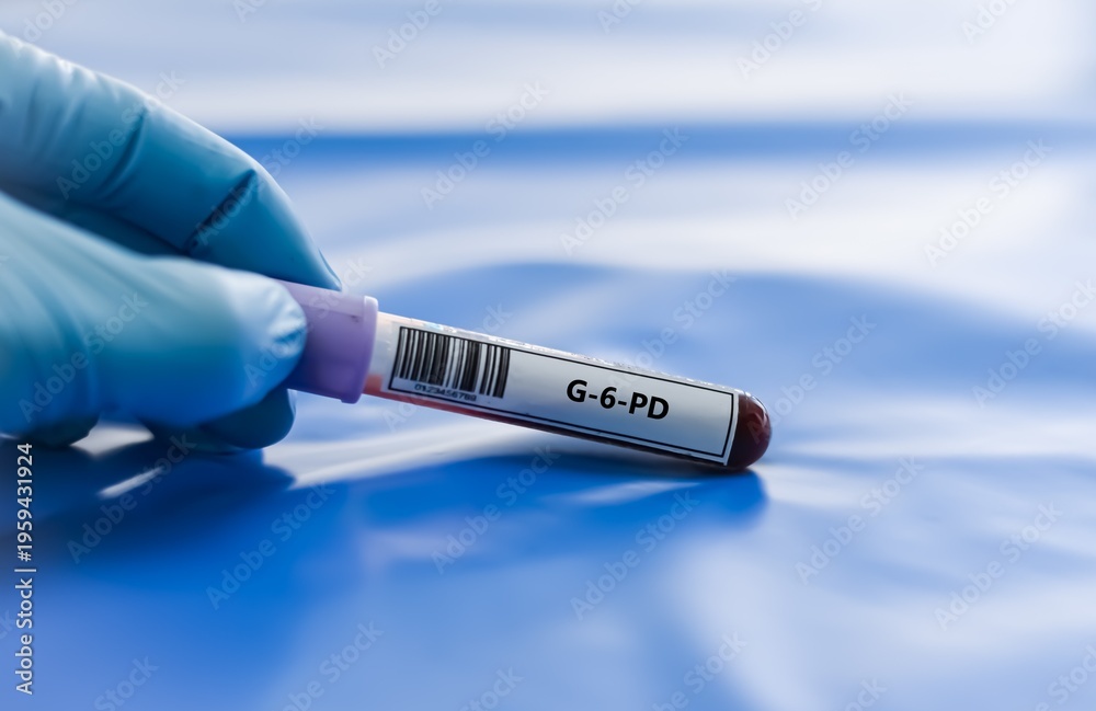 Obraz premium Blood sample tube for G-6-PD test analysis.