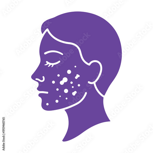 Woman's face with acne illustration in purple on white background skin care concept simple graphics