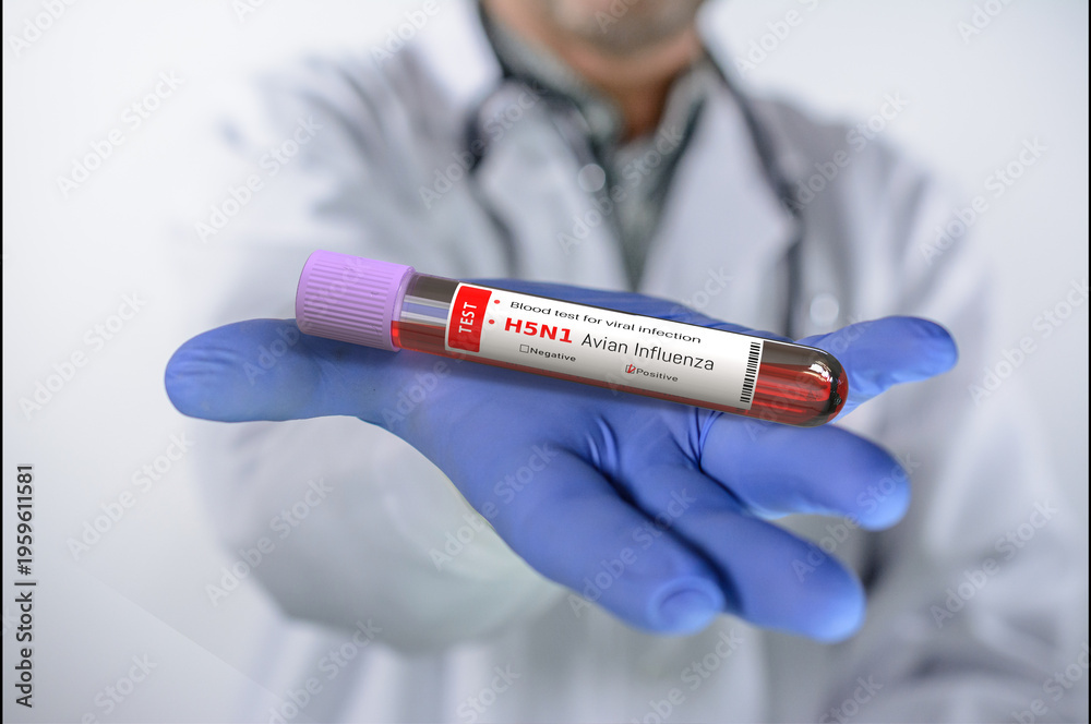 Naklejka premium Avian influenza. Doctor holds in his hand a blood test tube with Avian influenza test with positive result