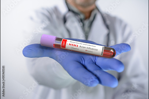 Avian influenza. Doctor holds in his hand a blood test tube with Avian influenza test with positive result