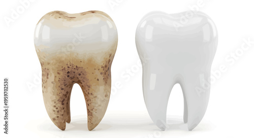 A comparison of a stained tooth and a clean tooth
