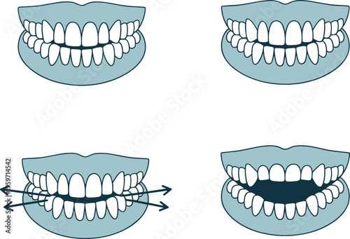 Teeth, dental, orthodontics, bite, alignment, smile, braces, occlusion, jaw, correction, dentistry, health, care, mouth, clinic, treatment, vector, medical, illustration, set