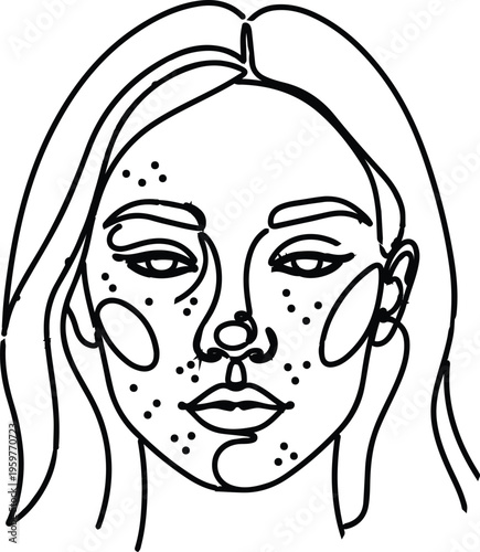 Minimalist continuous line art illustration of young woman with acne breakouts and skin blemishes for dermatology and skincare treatment
