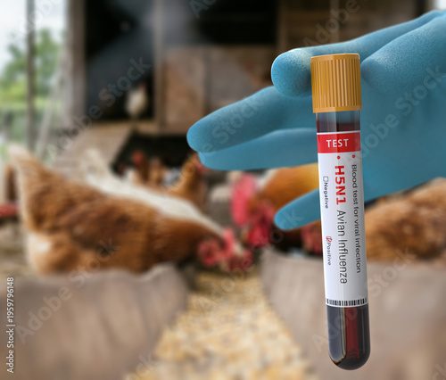 Doctor with blue glove holds a blood test tube for Avian influenza virus test