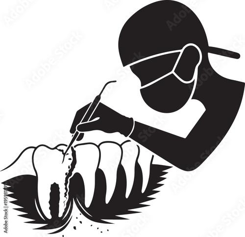 Subgingival root planing therapy