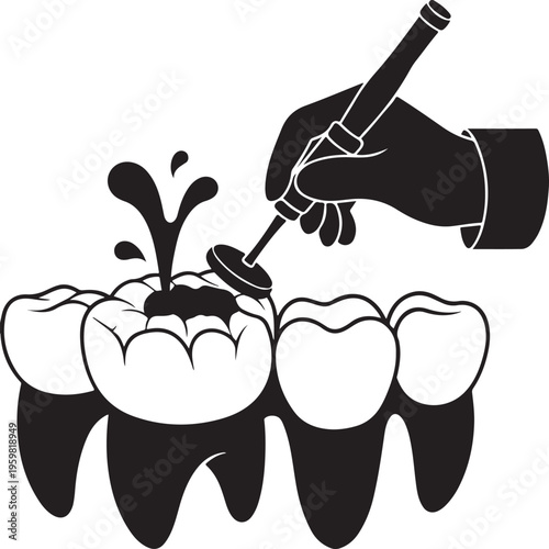 Composite restoration polishing