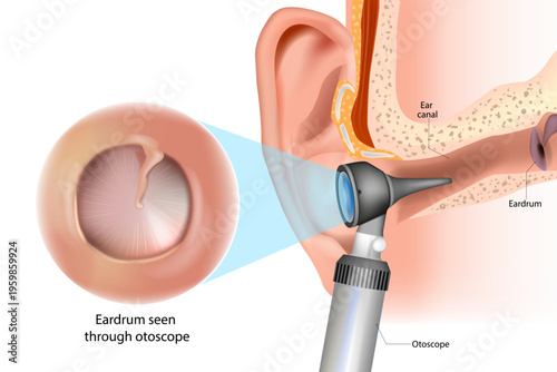 Otoscope Ear Examination Medical Illustration with Ear Canal and Eardrum Anatomy. ENT Examination with Otoscope Inside Ear Canal Medical Anatomy Illustration