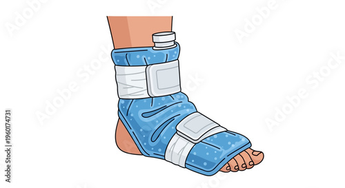 Vector illustration depicting a cold compress applied to an injured ankle and foot, providing effective first aid for pain relief, reducing swelling, and aiding recovery from sprains