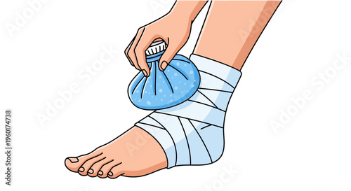 Vector illustration showcasing the essential technique of cold compress application and bandaging for ankle injury relief and rapid recovery and healing process