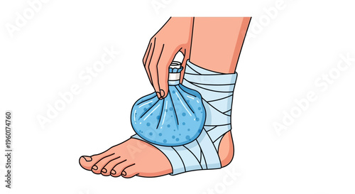 Illustration of Cold Compress Applied to Ankle for Pain Relief and Swelling Reduction, Vector Art