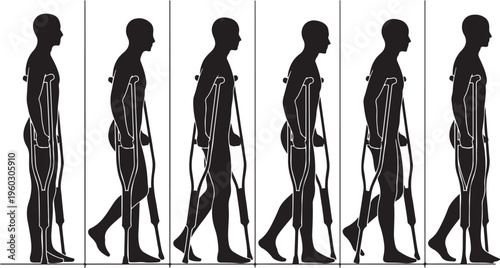 Silhouette Sequence of a Person Walking with Crutches, Medical Rehabilitation and Mobility Aid Gait Cycle Illustration for Injury or Broken Leg Recovery.