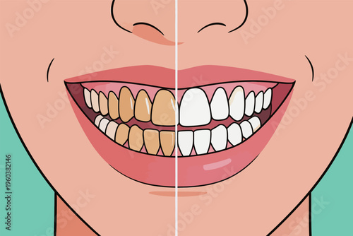 Before and after teeth whitening showing two different shades of teeth in dental care process