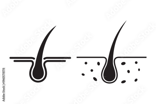 Human Hair Follicle and Root Anatomy Silhouette Icon Vector Set