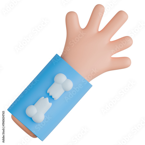 3D Arm Cast with Broken Bone Illustration