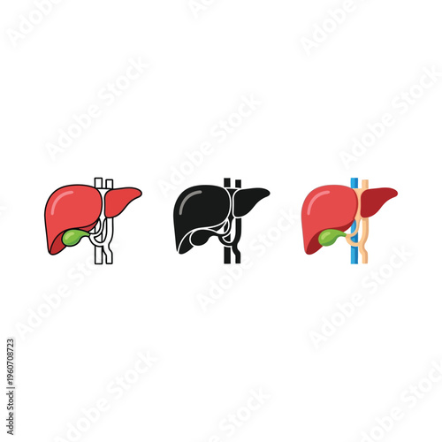 Illustration of liver anatomy and associated medical conditions