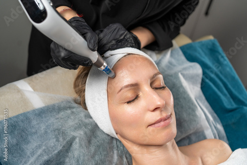 Woman in spa having professional microneedling treatment on her face for rejuvenation