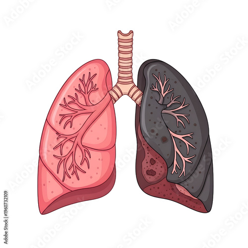 Human lungs illustration with healthy and unhealthy sections  