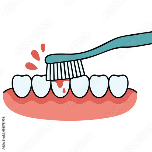 Brushing Teeth with Bleeding on Gum and Tooth Gingivitis Concept Dental Cartoon Vector