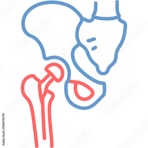 Hysterectomy Vector Icon