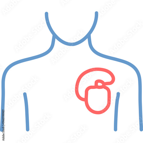 Pacemaker Implantation Vector Icon