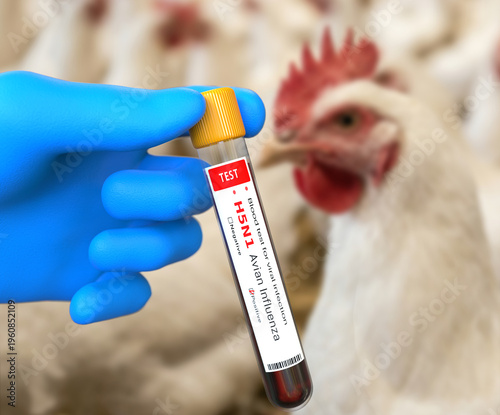 Doctor with blue glove holds a blood test tube for Avian influenza virus test